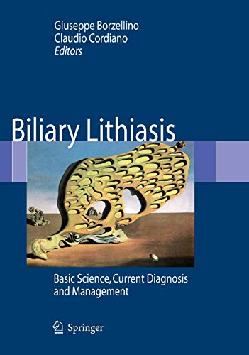 9788847007628: Biliary Lithiasis. Basic science, current diagnosis and management
