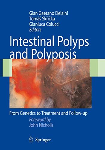 Beispielbild fr Intestinal Polyps and Polyposis. From Genetics to Treatment and Follow-up. zum Verkauf von Antiquariat im Hufelandhaus GmbH  vormals Lange & Springer