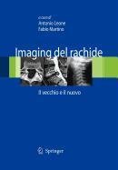 9788847012967: Imaging del Rachide