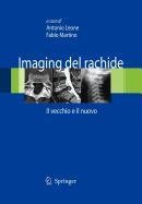 9788847012967: Imaging del rachide (Italian Edition)