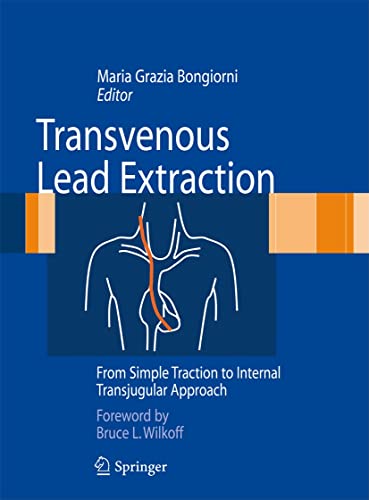 Beispielbild fr Transvenous Lead Extraction. From Simple Traction to Internal Transjugular Approach. zum Verkauf von Gast & Hoyer GmbH