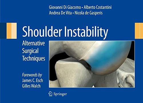 Imagen de archivo de Shoulder instability. Alternative surgical techniques a la venta por Homeless Books