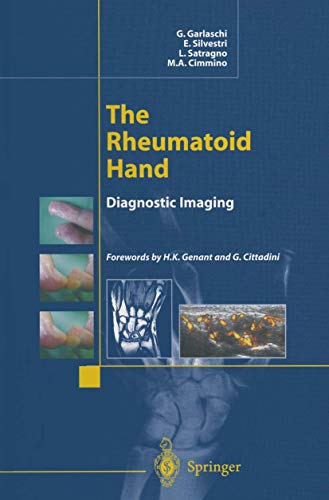 The Rheumatoid Hand: Diagnostic Imaging (9788847022683) by Garlaschi, G.; Silvestri, E.; Satragno, L.; Cimmino, M.A.