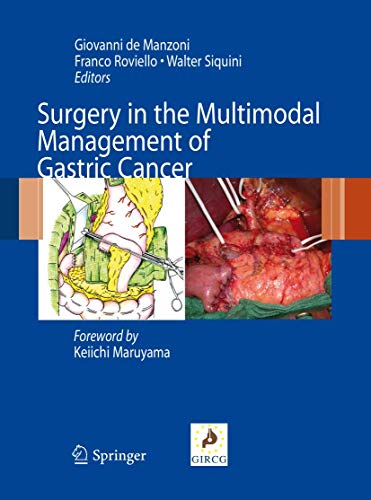 Imagen de archivo de Surgery in the Multimodal Management of Gastric Cancer. a la venta por Antiquariat im Hufelandhaus GmbH  vormals Lange & Springer