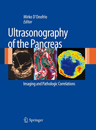 Stock image for Ultrasonography of the Pancreas for sale by Blackwell's