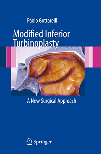 Beispielbild fr Modified Inferior Turbinoplasty. A New Surgical Approach. zum Verkauf von Gast & Hoyer GmbH