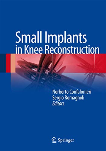 Beispielbild fr Small Implants in Knee Reconstruction. zum Verkauf von Antiquariat im Hufelandhaus GmbH  vormals Lange & Springer