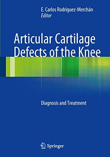 Beispielbild fr Articular Cartilage Defects of the Knee. Diagnosis and Treatment. zum Verkauf von Gast & Hoyer GmbH