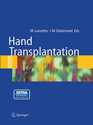 9788847057968: Hand transplantation