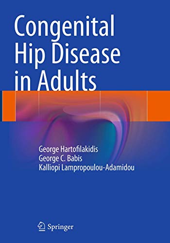 9788847058774: Congenital Hip Disease in Adults