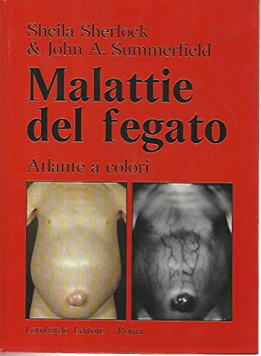 Imagen de archivo de ATLANTE A COLORI DI MALATTIE DEL FEGATO a la venta por Librightbooks