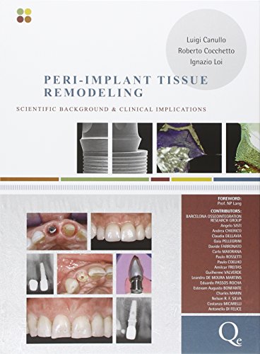 9788874921669: Peri-implant tissue remodeling. Scientific background and clinical implications: Scientific Background & Clinical Implications