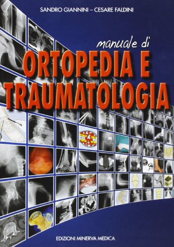 9788877116208: Minerva Manuale di ortopedia e traumatologia