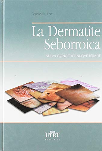 9788879332323: La dermatite seborroica