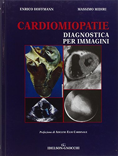 Cardiomiopatie. Diagnostica per Immagini