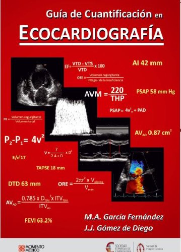 9788881602223: Guda de cuantificacon en ecocardiografia