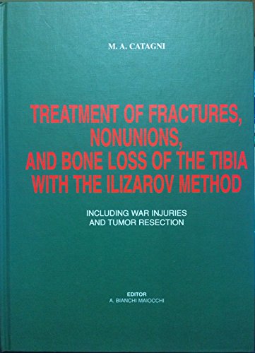 9788890025013: Treatment of fractures, nounions and bone loss of the tibia with the Ilizarov method