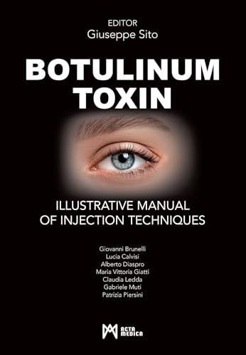 9788897438694: Botulinum toxin. Ilustrative manual of injection techniques. Ediz. a colori: Illustrative Manual of Injection Techniques