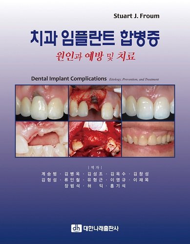 9788957412428: 치과임플란트 합병증 원인과 예방 및 치료(Dental Implant Complications Etiology, Prevention, and Treatment)