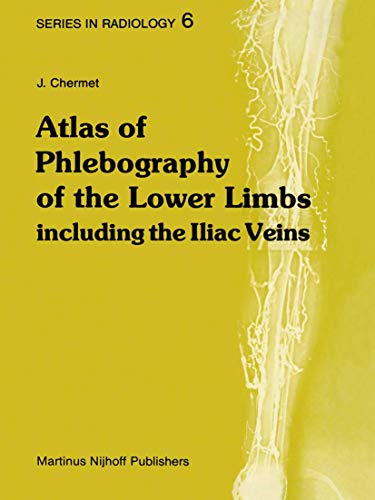 Stock image for Atlas of Phlebography of the Lower Limbs: Including the Iliac Veins (Series in Radiology) for sale by Hippo Books