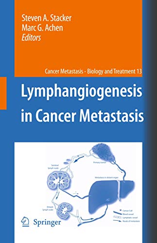9789048122462: Lymphangiogenesis in Cancer Metastasis (Cancer Metastasis - Biology and Treatment, 13)