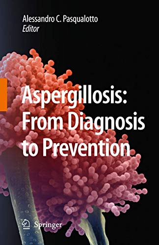 9789048124077: Aspergillosis: from diagnosis to prevention