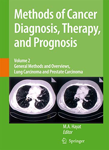 Methods of Cancer Diagnosis, Therapy and Prognosis - Hayat, M. A.