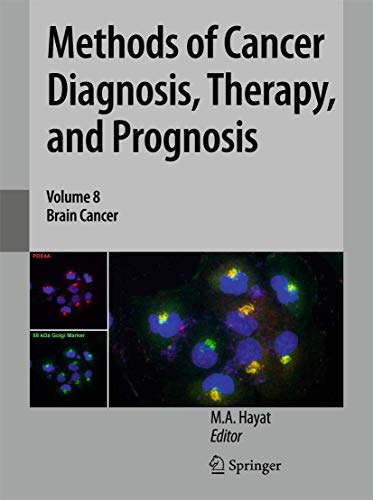 9789048186648: Methods of Cancer Diagnosis, Therapy, and Prognosis: Brain Cancer: 8