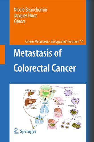 Stock image for Metastasis of Colorectal Cancer: 14 (Cancer Metastasis - Biology and Treatment) for sale by Bright Study Books