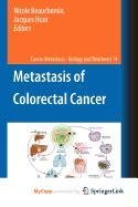 9789048188505: Metastasis of Colorectal Cancer