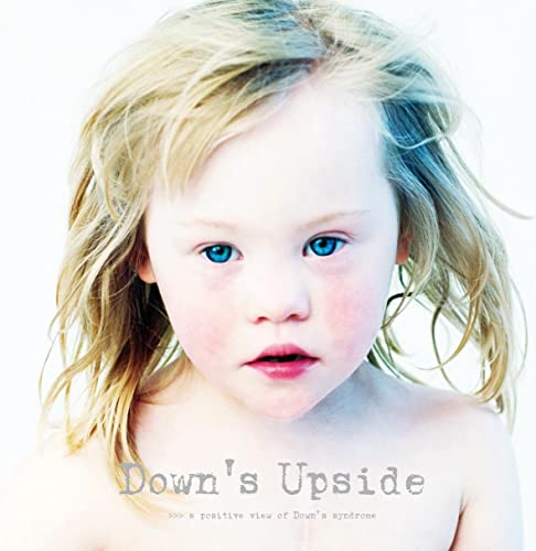 9789049106836: Down's Upside: A Positive View of Down's Syndrome