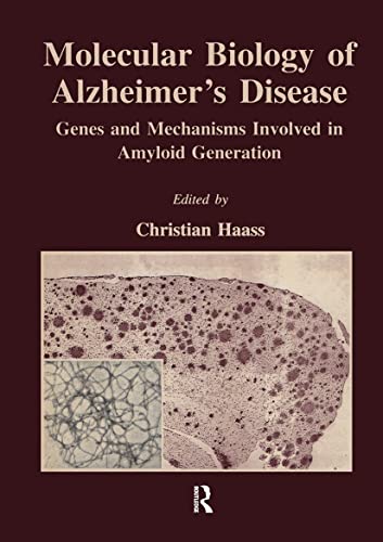 9789057023811: Molecular Biology of Alzheimer's Disease: Genes and Mechanisms Involved in Amyloid Generation