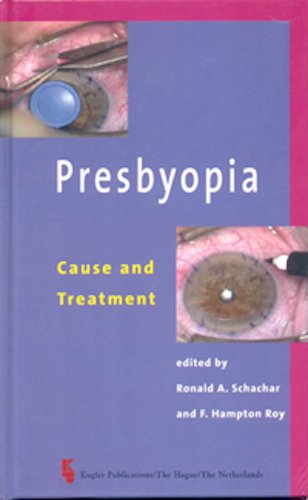 Beispielbild fr Presbyopia: Cause and Treatment zum Verkauf von HPB-Red