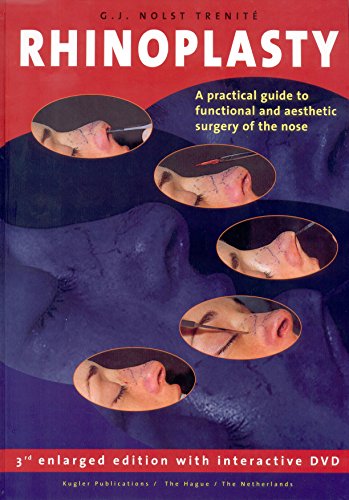 Stock image for Rhinoplasty - Book (3rd enlarged edition): A practical guide to functional and aesthetic surgery of the nose for sale by Zubal-Books, Since 1961