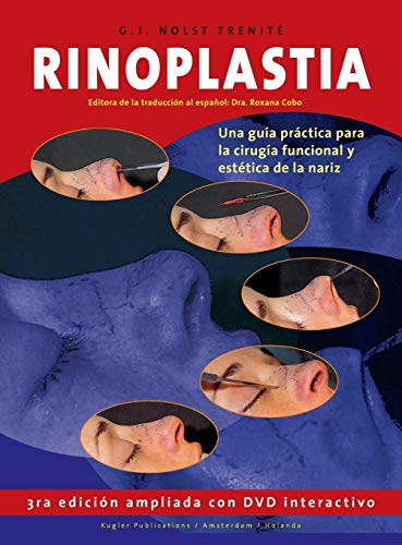 9789062992461: Rinoplastia Una gua prctica para la ciruga funcional y esttica de la nariz (Spanish Edition)