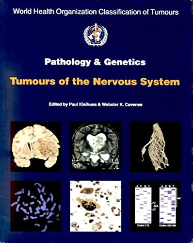 Beispielbild fr Pathology and Genetics of Tumours of the Nervous System zum Verkauf von Anybook.com