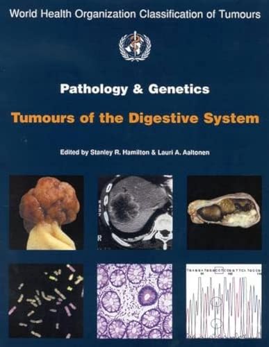 Beispielbild fr Pathology and Genetics of Tumours of the Digestive System zum Verkauf von HPB-Red