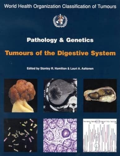 9789283224105: Pathology and genitics of tumours of the digestive system: Pathology and Genetics of Tumours of the Digestive System (World Health Organization Classification of Tumours S.)