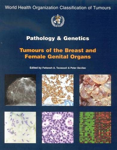 Imagen de archivo de Pathology and Genetics Tumours of the Breast and Female Genital Organs (World Health Organization Classification of Tumours) a la venta por Devils in the Detail Ltd