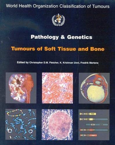 Pathology and Genetics of Tumours of Soft Tissue and Bone (IARC WHO Classification of Tumours) - The International Agency For Research On Cancer