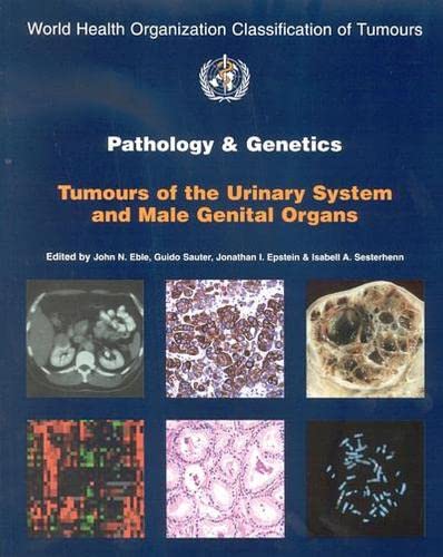 Stock image for Pathology and Genetics of Tumours of the Urinary System and Male Genital Organs (IARC WHO Classification of Tumours) for sale by SecondSale