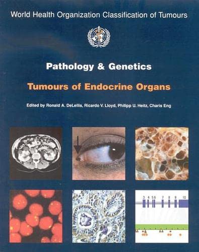 Imagen de archivo de Pathology and Genetics of Tumours of Endocrine Organs [OP] (Medicine) a la venta por HPB-Red