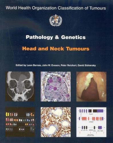 9789283224174: Pathology and genetics of head and neck tumours (World Health Organization Classification of Tumours)