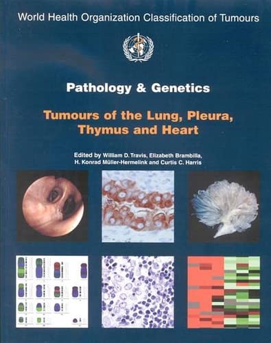 9789283224181: Pathology and Genetics of Tumours of the Lung, Pleura, Thymus and Heart: 10 (IARC/World Health Organization Classification of Tumours)