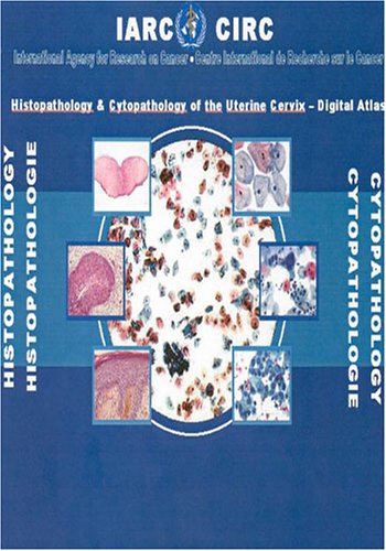 Histopathology and Cytopathology of the Uterine Cervix: Digital Atlas (9789283224242) by Frappart, L.; Lucas, E.; Sankaranarayanan, R.