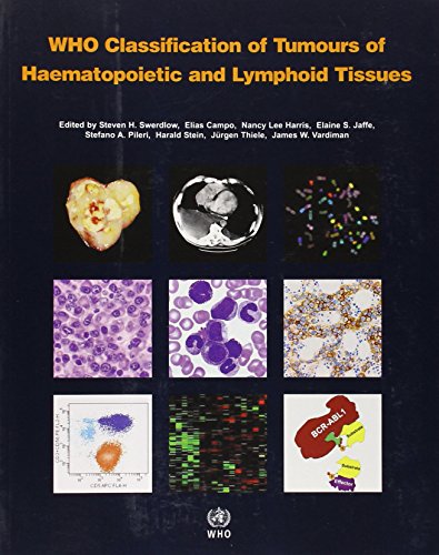 9789283224310: WHO Classification of Tumours of Haematopoietic and Lymphoid Tissue [OP] (Medicine)