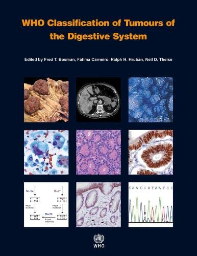 9789283224327: WHO Classification of Tumours of the Digestive System