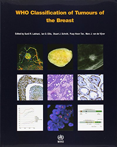 Beispielbild fr WHO Classification of Tumours of the Breast [OP] (Medicine) zum Verkauf von SecondSale