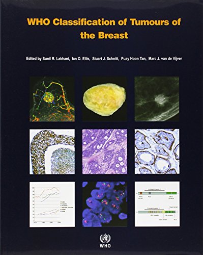 9789283224334: WHO Classification of Tumours of the Breast [OP] (Medicine)