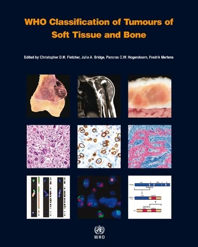 9789283224341: WHO Classification of Tumours of Soft Tissue and Bone: WHO Classification of Tumours, Volume 5 (World Health Organization classification of tumours)